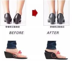 Esnek Düz Taban Düzeltici Topuk Yastığı Siyah veya Beyaz Gönderilir